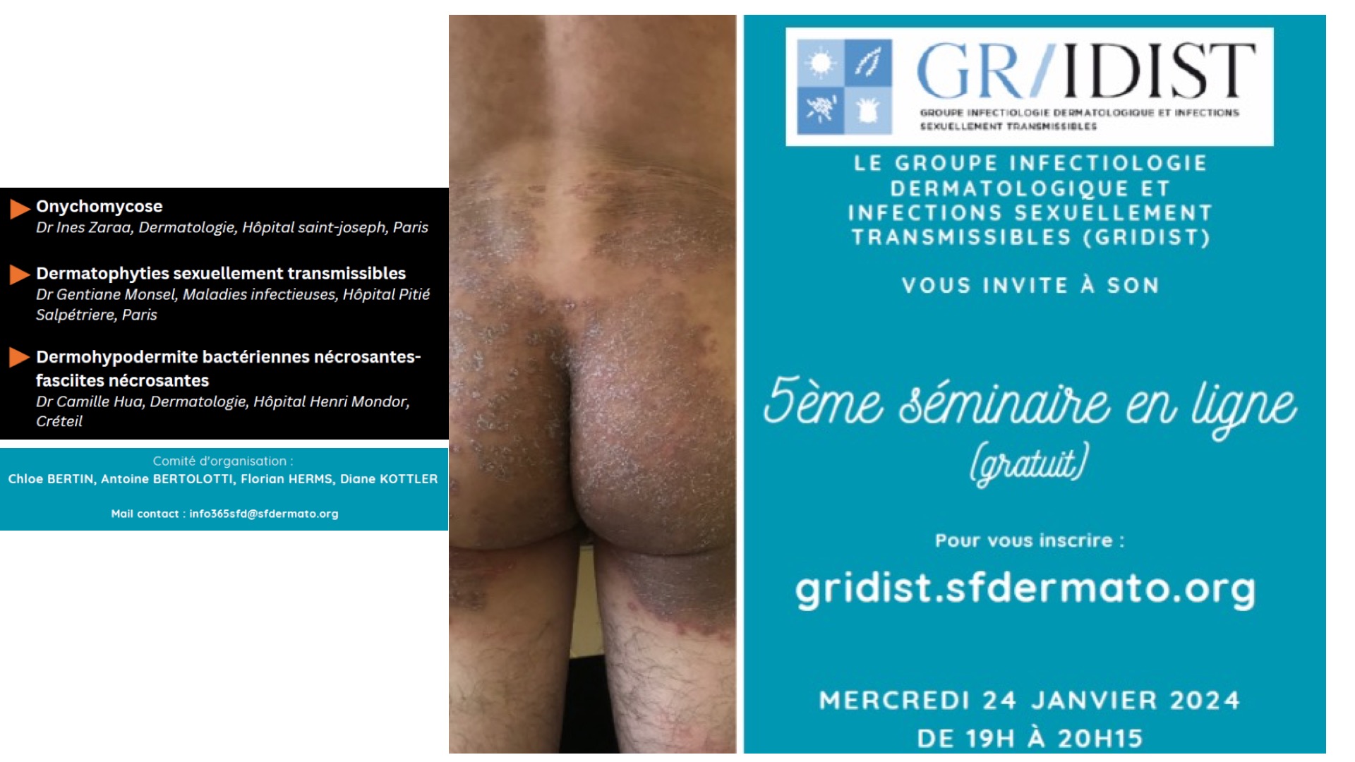 Replay du 5ème séminaire en ligne du Gridist Exemplaire